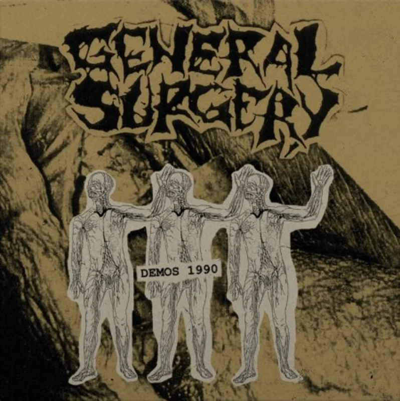 General Surgery - Demos 1990 NEW METAL LP